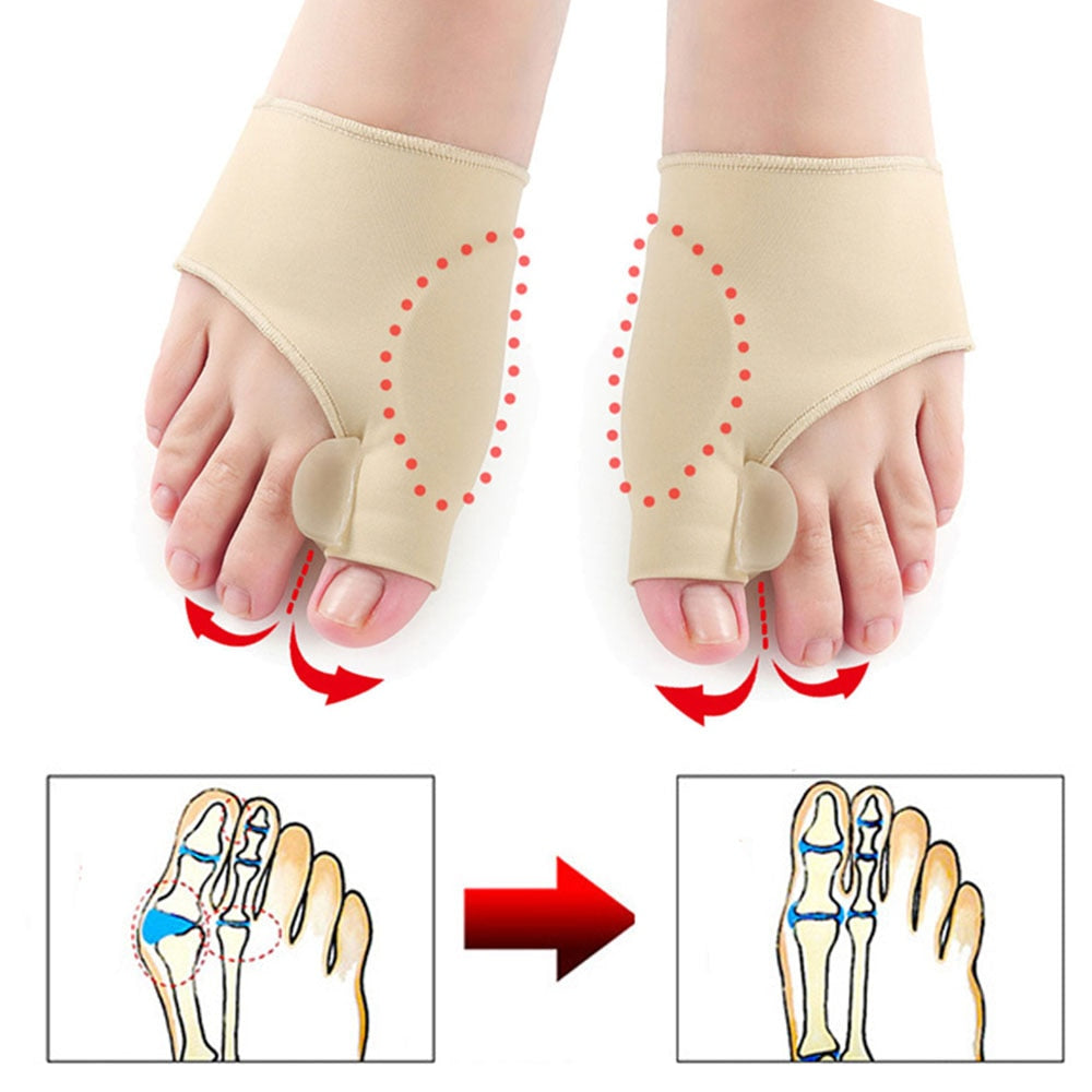 2Pcs=1Pair Toe Separator Hallux Valgus Bunion Corrector Orthotics Feet Bone Thumb Adjuster Correction Pedicure Sock Straightener - DreamWeaversStore